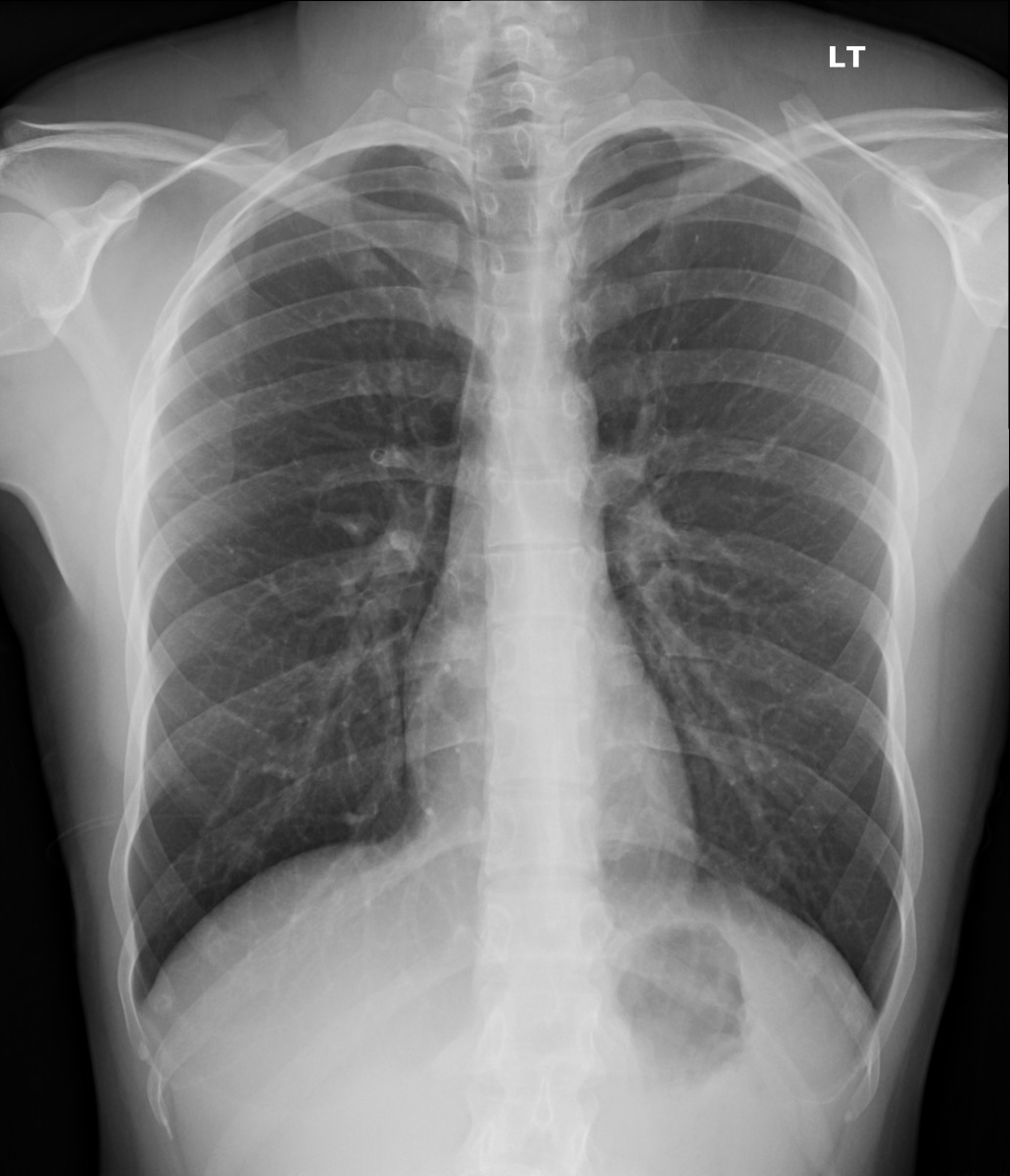 ribcage avatar